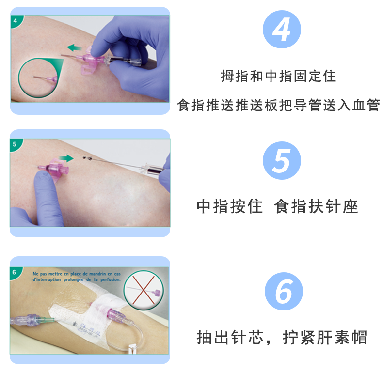 德國貝朗 Introcan-W 英初康 動靜脈留置針（帶翼） 